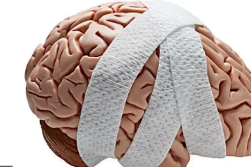 a human brain wrapped in bandages